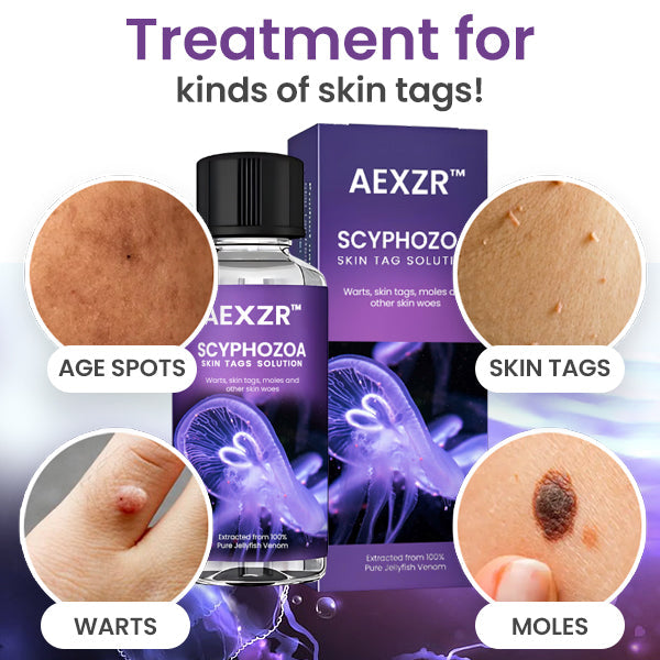 AEXZR™ Scyphozoa Skin Tags Solution - 👩⚕️ Recommended by Experts 💥 80% Limited Discounts 🎉