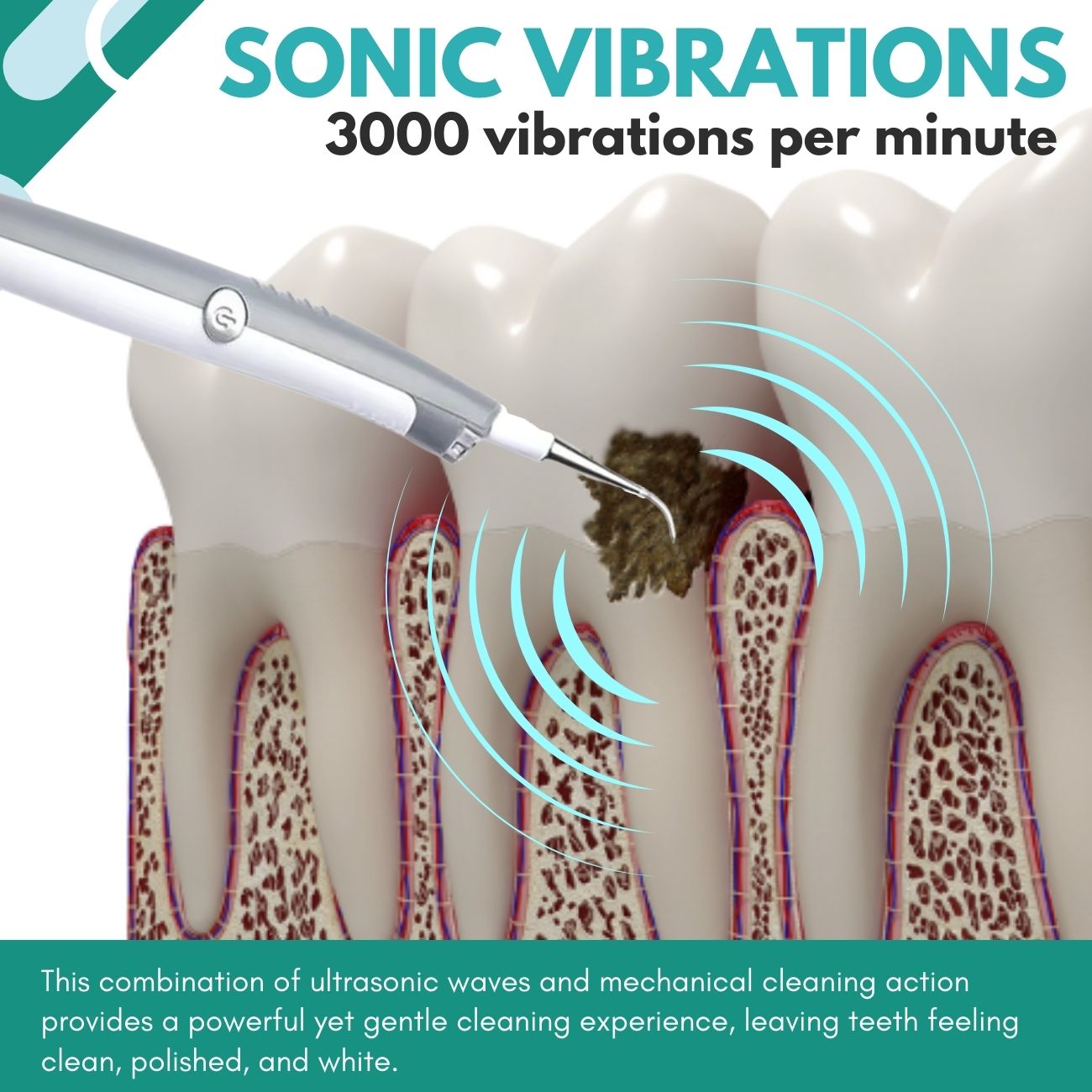 ✅Official Store - Hypethetic Pharmacy| AEXZR™ Plaque & Stain Remover