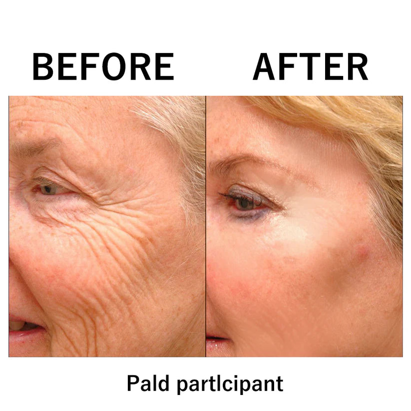 đ„ Instant Temporary Face Tightener