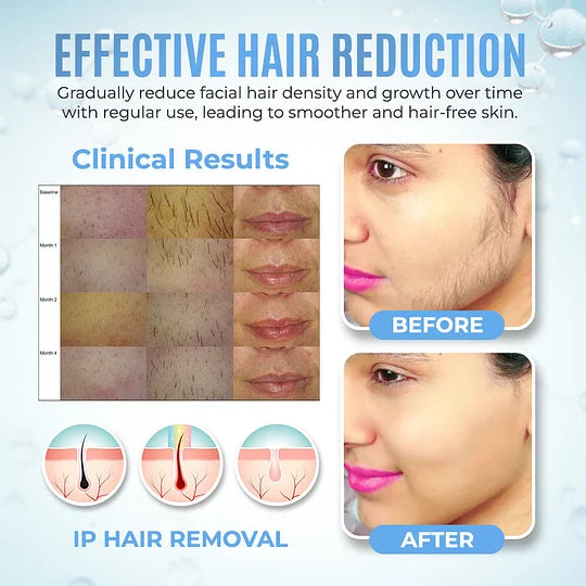 BQYOOM™ PCOS Facial Hair Natural Treatment At Home