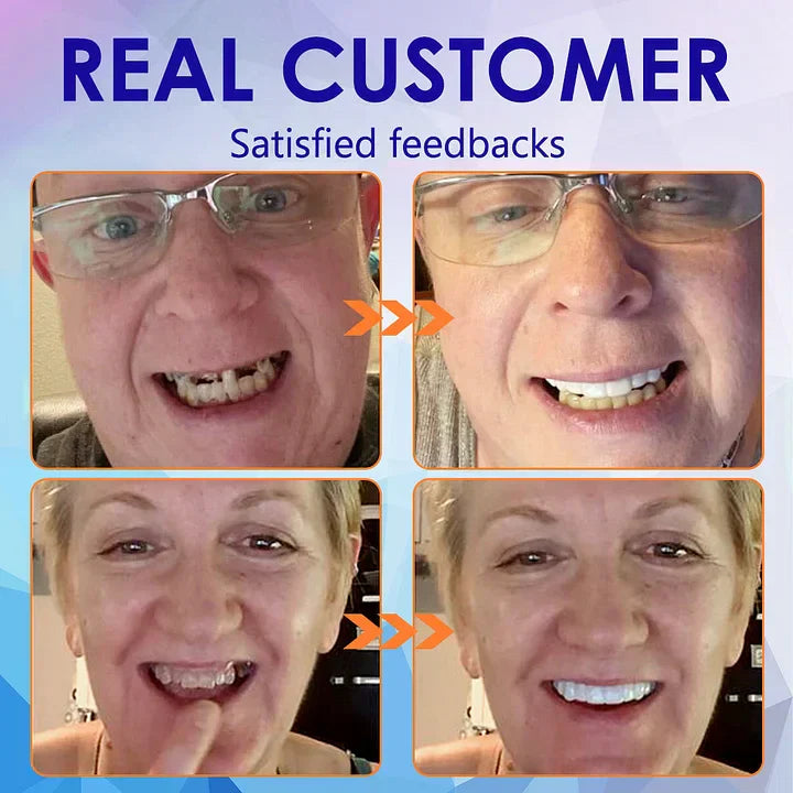 Bikendaā¢-š¦·Advanced Customized Full Denture Setš¦·-The Royal London Dental Hospital accreditation(ā°Limited Time Discount Last 30 Minutesā°)šš