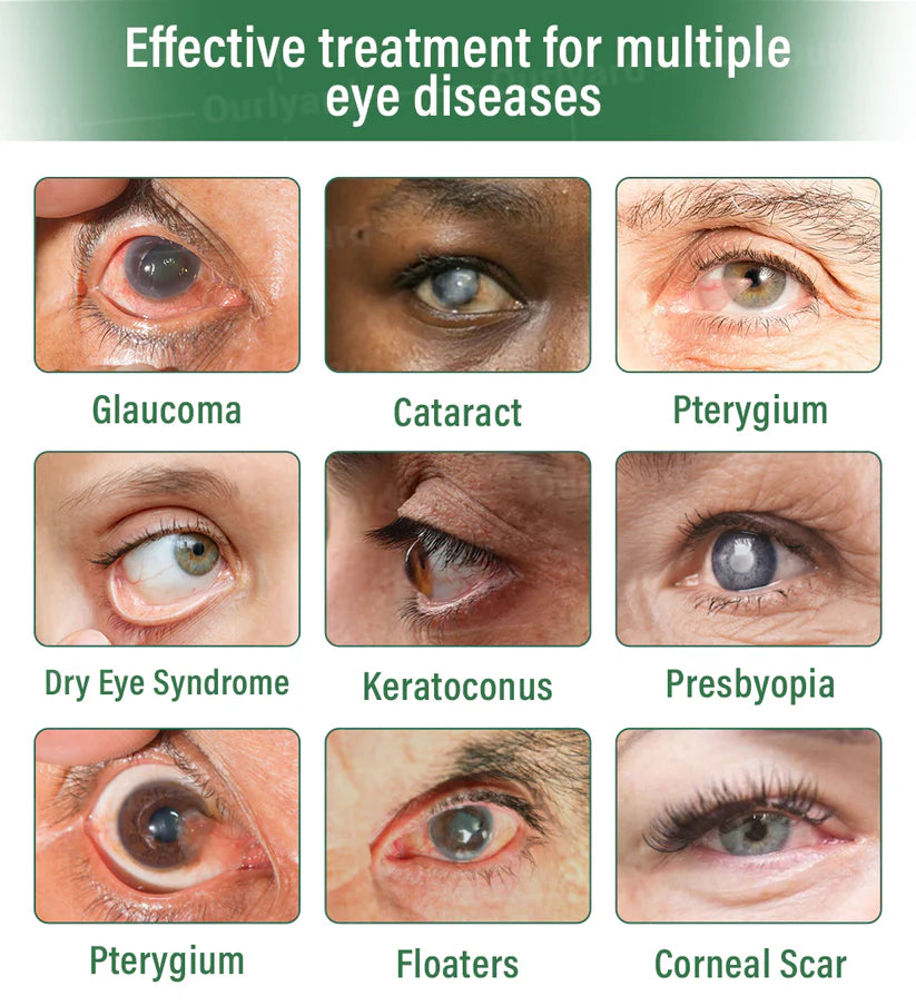 đ¨đťââď¸OurlyardÂŽ OptiClear DualTech Eye Drops â
ď¸ TGA Approved | Supports Presbyopia, Dry Eyes, Glaucoma & Cataracts đŚ