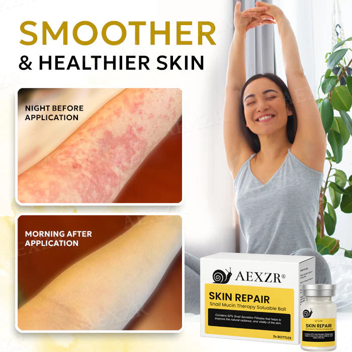 š Official Store | AEXZRĀ® Skin Repair Snail Mucin Therapy Soluble Ballš ā Heal Your Skin, Restore Your Confidence! AEXZRĀ® Skin Repair Snail Mucin Therapy Soluable BallāØ