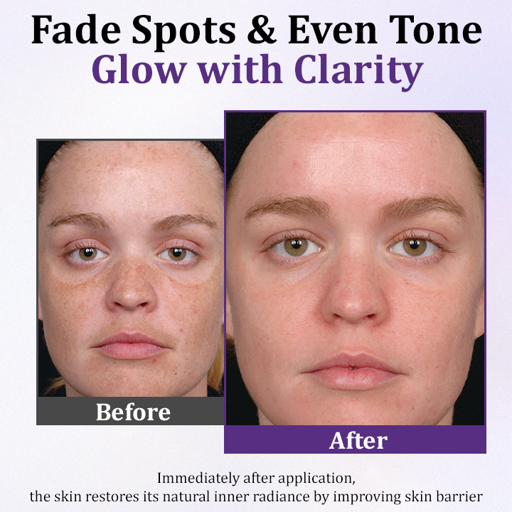 Ceoerty™ PigmentaX ProFade Anti-Hyperpigmentation Cream