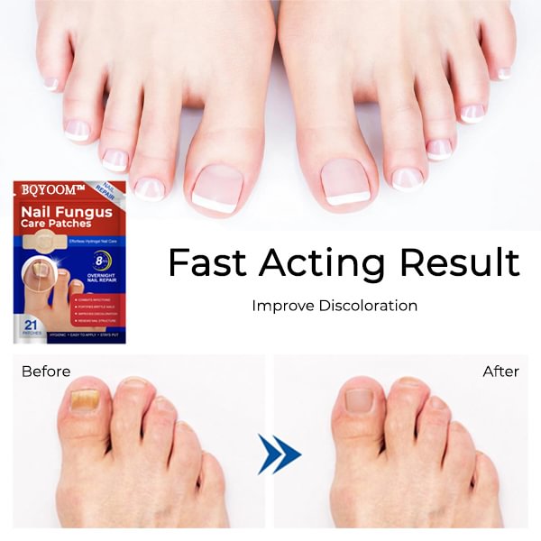 BQYOOM™ Nail Fungus Care Patches
