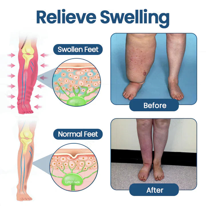 ATTDX® Roll-On Pump Cream for Lymphatic Drainage & Swelling Relief