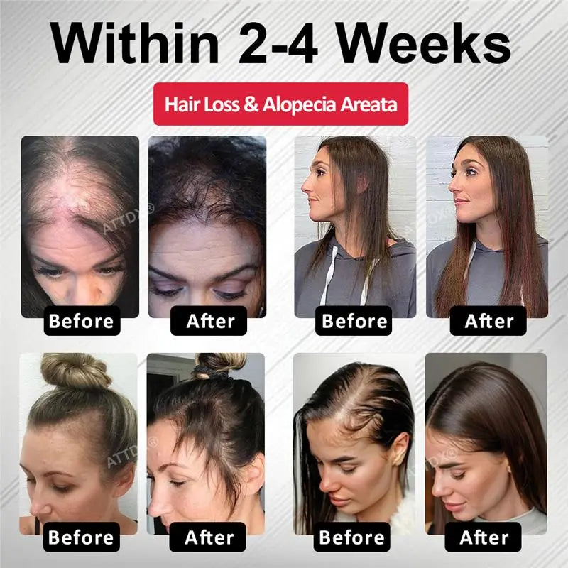 ATTDX® Hair Reawaken PP405 Roll-On Serum for Women