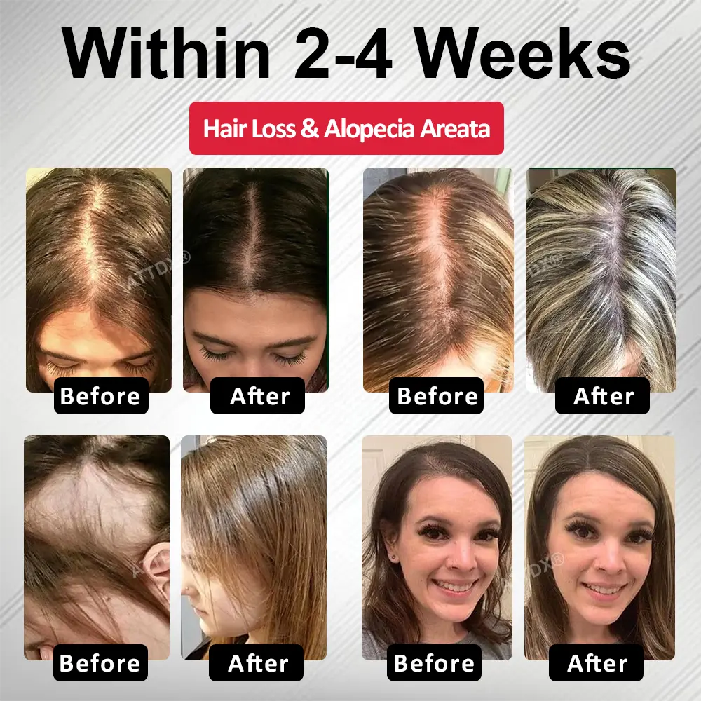 ATTDX® Hair Reawaken PP405 Roll-On Serum for Women