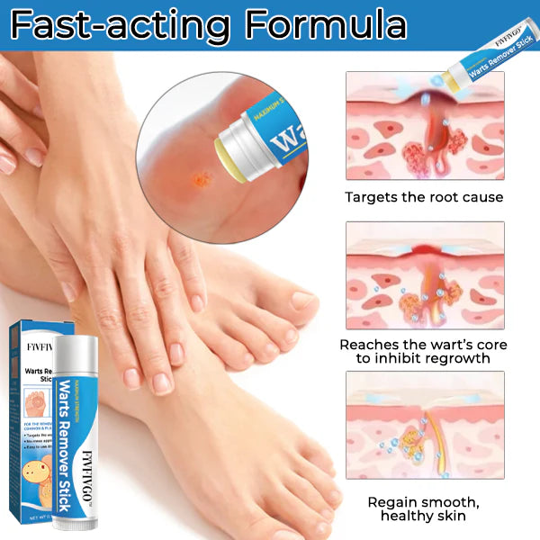 Fivfivgo® Warts Remover Stick
