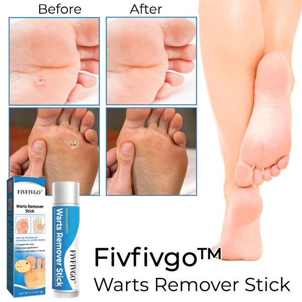 Fivfivgo® Warts Remover Stick