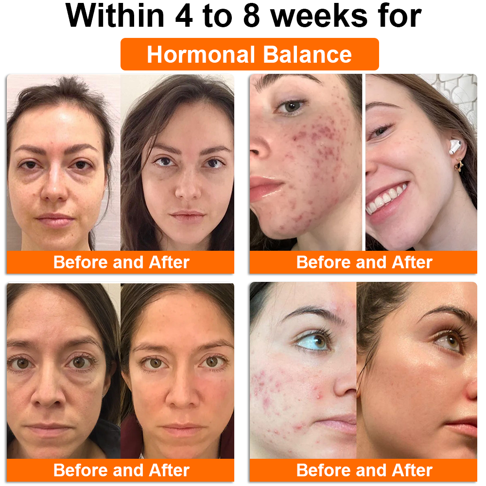 Anniecare® Bee Venom Natural Recovery Capsules - Supports female hormone balance, pH balance, menopause and skin health