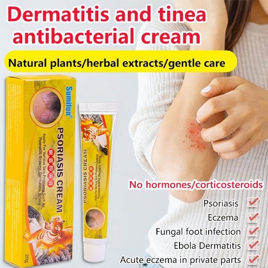 Dermatitis and Tinea Antibacterial Psoriasis Cream