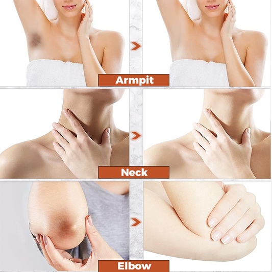 South Moon™ AcanthoClear Therapy Spray