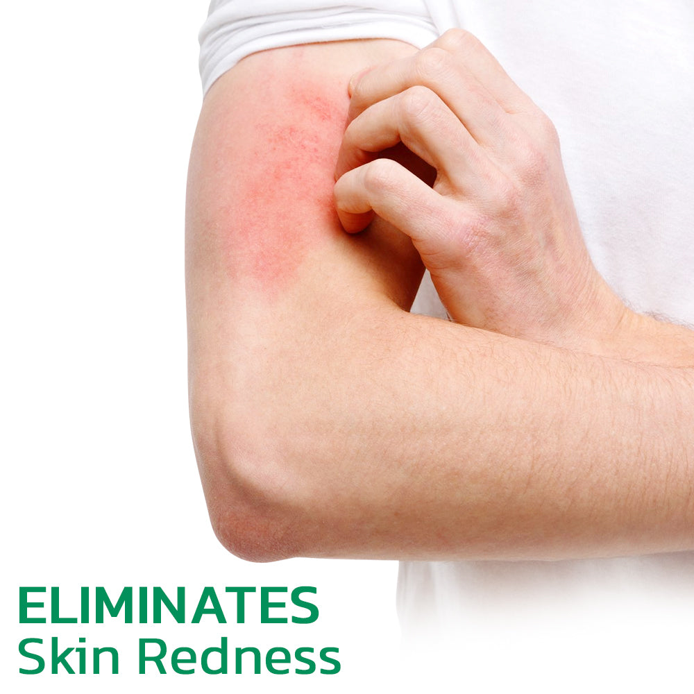 EczoTherapy Herbal Hydration Cream