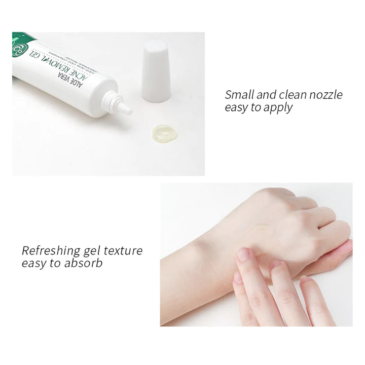 BioLap™ Aloe Vera Acne Serum Gel