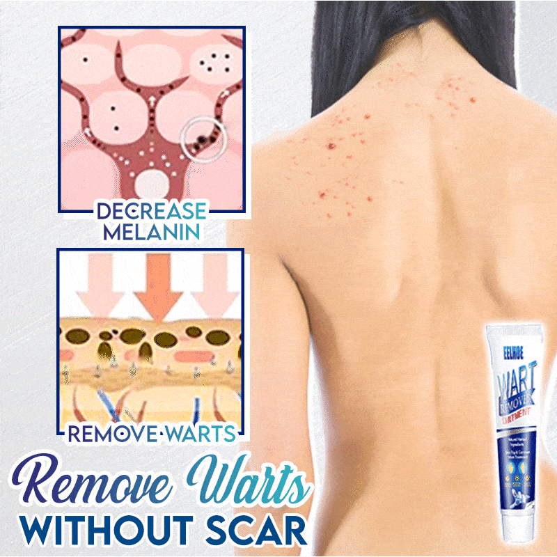 NEW!🌟Instant Blemish Removal Gel Women-002 DazzyCandy