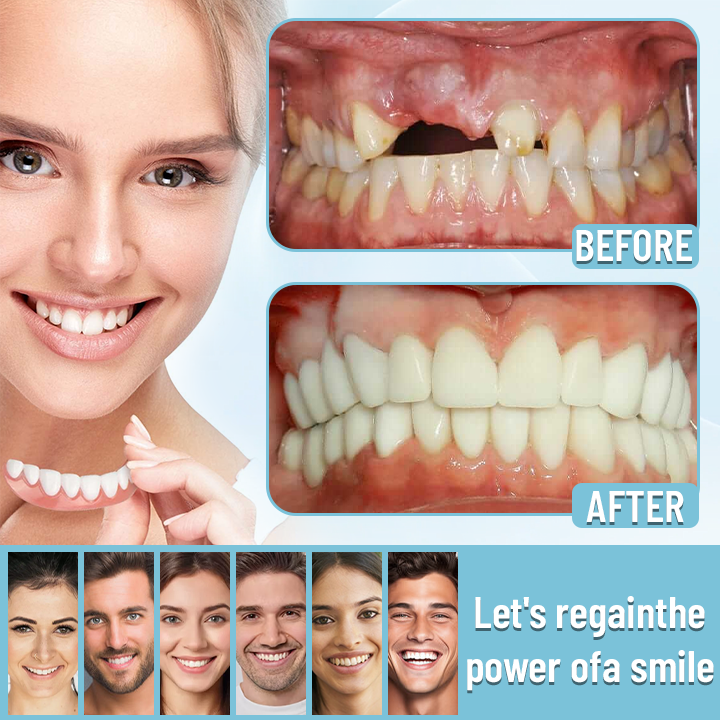 Bikenda™-🦷Advanced Customized Full Denture Set🦷-The Royal London Dental Hospital accreditation(⏰Limited Time Discount Last 30 Minutes⏰)🌈🌈