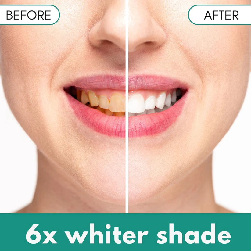 ✅Official Store - Hypethetic Pharmacy| AEXZR™ Plaque & Stain Remover