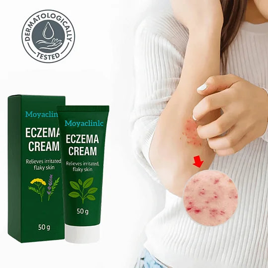 Eczema Relief Cream: Banish 99% of Itching in Just 1 Minute!