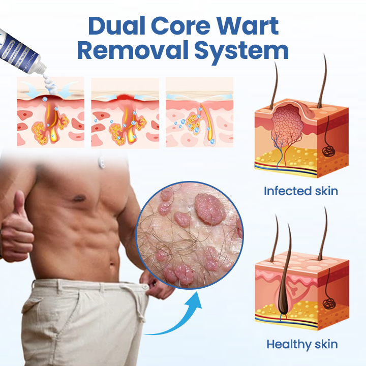 Fivfivgo® GentX WartRelief Cream