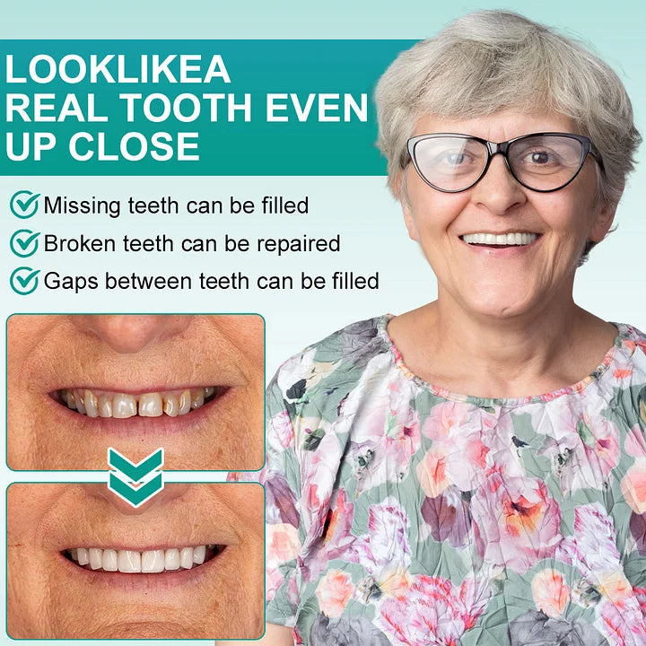 🧑‍⚕️🦷 YUNPSO™ Instant Stick-On Dental Veneers