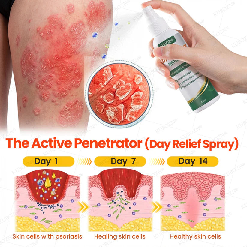 👨‍⚕️ KUBOZN® Psoriasis Day & Night Repair System - 100% Steroid-Free Relief Duo for Plaques, Scaling & Itch