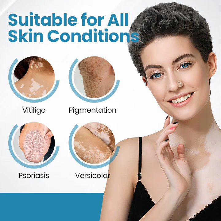 Nurbini®DermaBeam Vitiligo Therapy Device