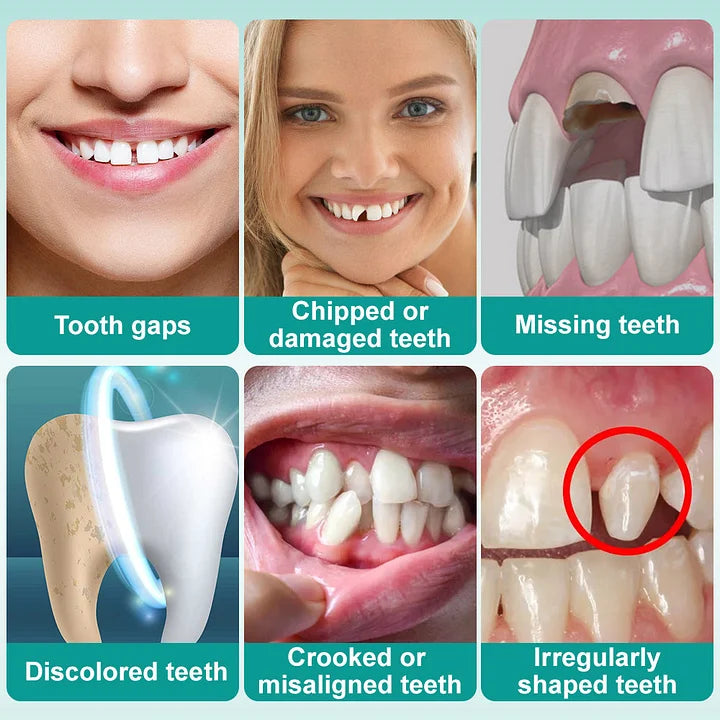 🧑‍⚕️🦷 YUNPSO™ Instant Stick-On Dental Veneers