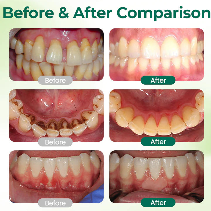 Ceoerty® Zero-Waste Mouth Tabs