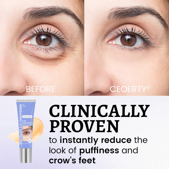 Ceoerty® InstaLift Eye Tightener – 10 Seconds to Younger, Fresher Eyes