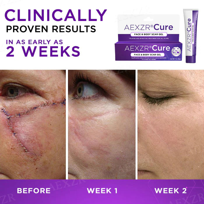 AEXZR® Cure Face & Body Scar Gel – Clinically proven to soften, flatten and fade surgical scars, acne marks, burns, keloids and trauma-related scars.