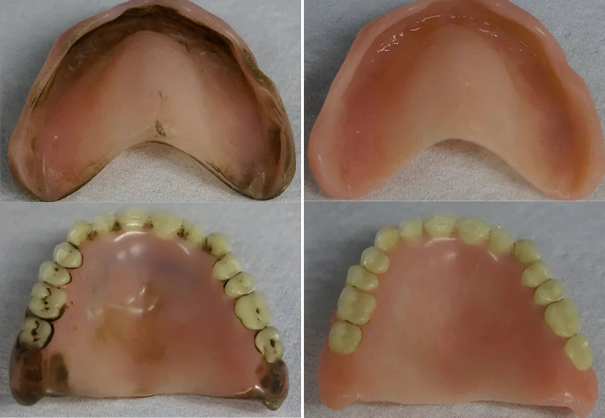 This New Denture Cleaning Invention Is Taking The US By Storm-Braces cleaning machine