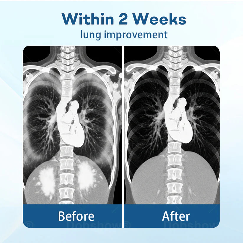Cvreoz® DoubleNano Advanced Lung Detox Patch for Relief