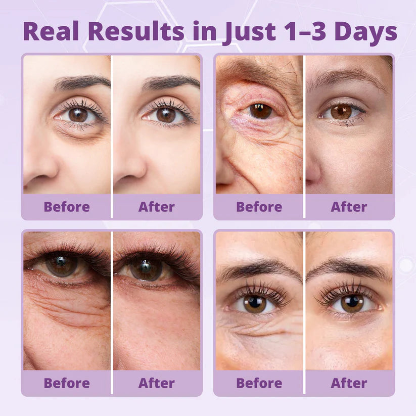 🔥LIMITED SPECIAL OFFER🔥 Dobshѳw® Instant Filter Eye Firmer