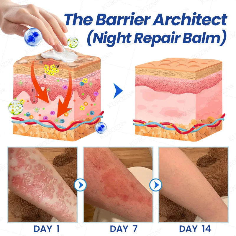 👨‍⚕️ KUBOZN® Psoriasis Day & Night Repair System - 100% Steroid-Free Relief Duo for Plaques, Scaling & Itch