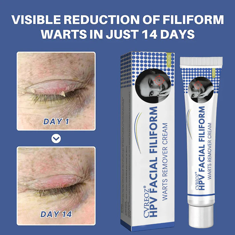 Cvreoz® HPV Facial Filiform Warts Removal Cream
