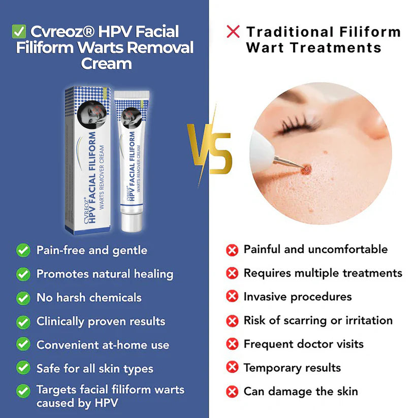 Cvreoz® HPV Facial Filiform Warts Removal Cream