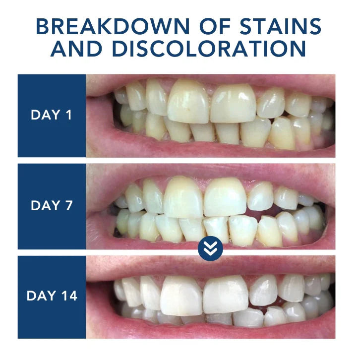 Laser Smile Care Device — 🦷 Bright Smile · Gum Health · Daily Care