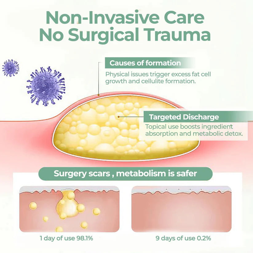 ⏰Last Day Promotion: 60% OFF🔥 Cvreoz® Lipoma Herbal Relief Cream