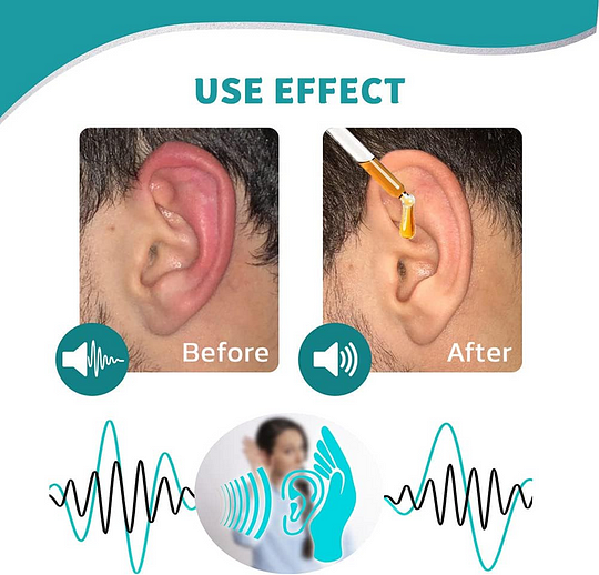 BQYOOM™ Ear Care Drops – Plant-Based Formula | FDA-Registered