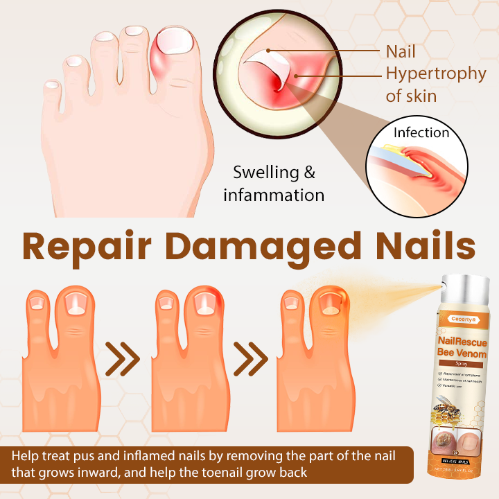 Ceoerty® NailRescue Bee Venom Spray