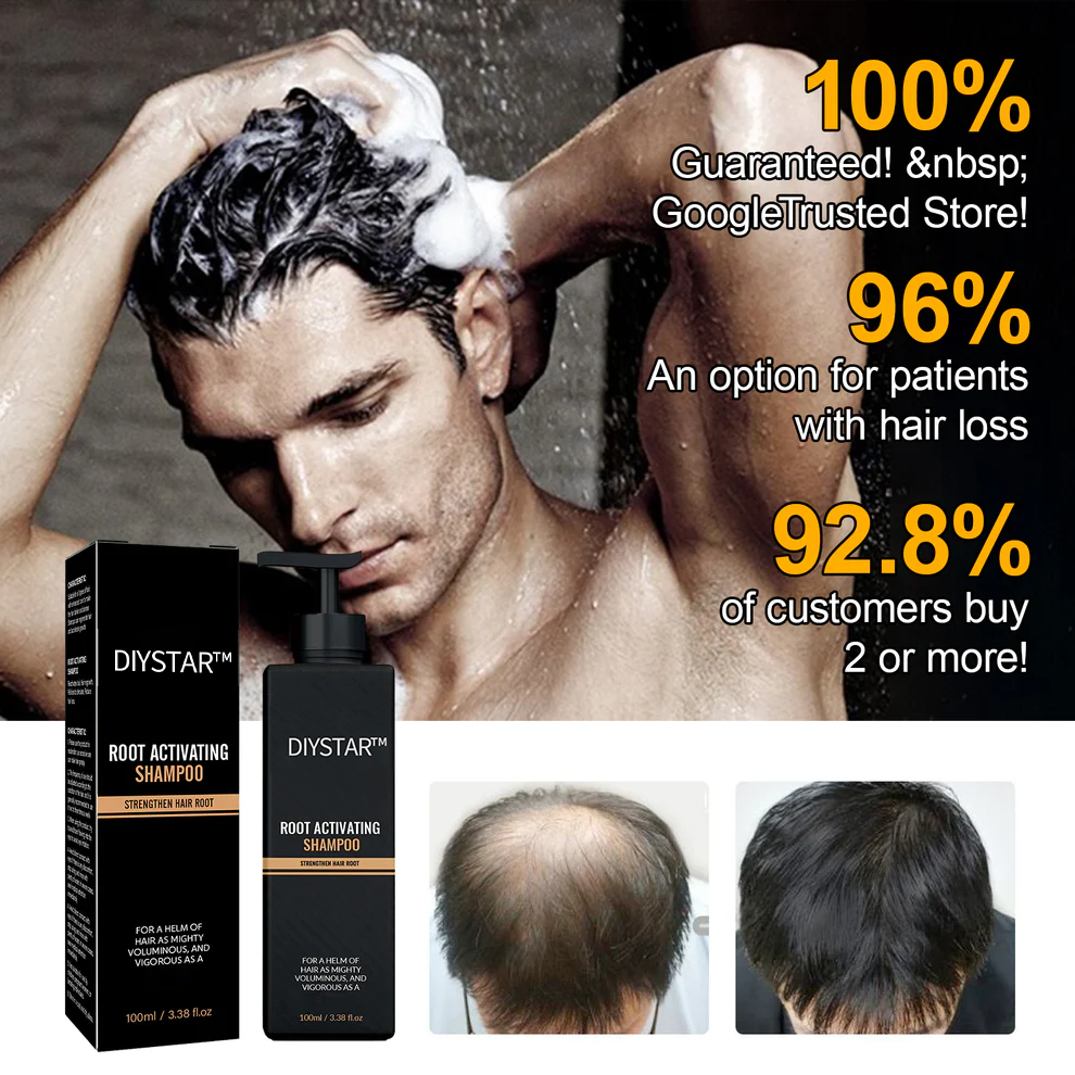 Easter Sale Countdown!⏰DIYSTAR™Root Activator Shampoo- Regain a full head of hair in just 4 weeks!