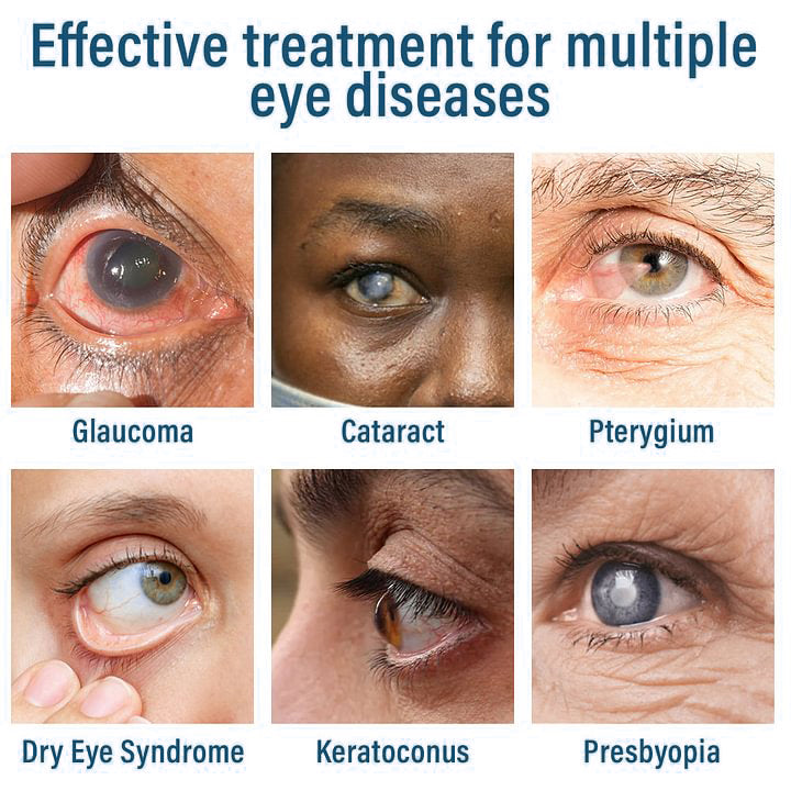 👩‍⚕️ROSOPLTM Nano Eye Drops Spray is developed by ophthalmologists and is backed by practical results.