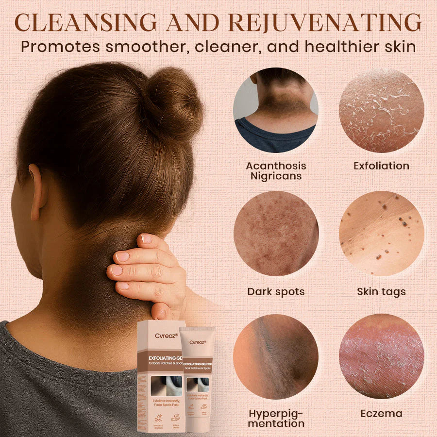 Cvreoz® Purifying Exfoliating Gel for Acanthosis Nigricans, Exfoliation, Dark Spots, Skin Tags, and Eczema