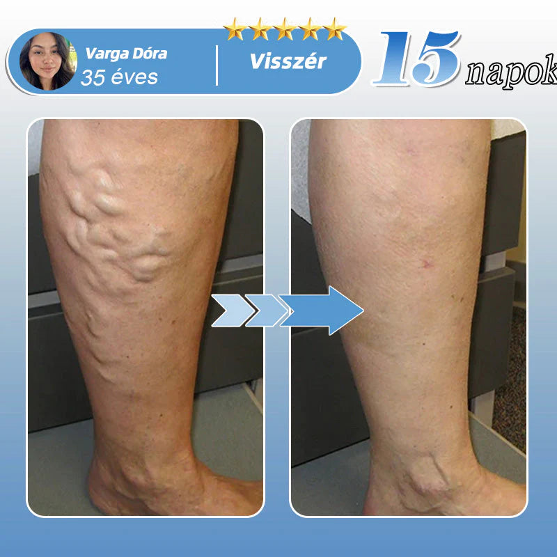 🛒✅𝐇𝐞𝐚𝐥𝐫𝐢𝐳𝐞® MoveFree Vital Patch⚡Trace elements and herbal support🌱Diabetes, varicose veins, arthritis, nerve pain-🛒