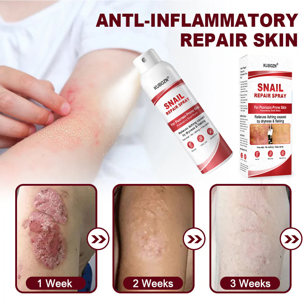 KUBOZN® Snail Repair Spray for Itchy, Flaky Psoriasis Skin