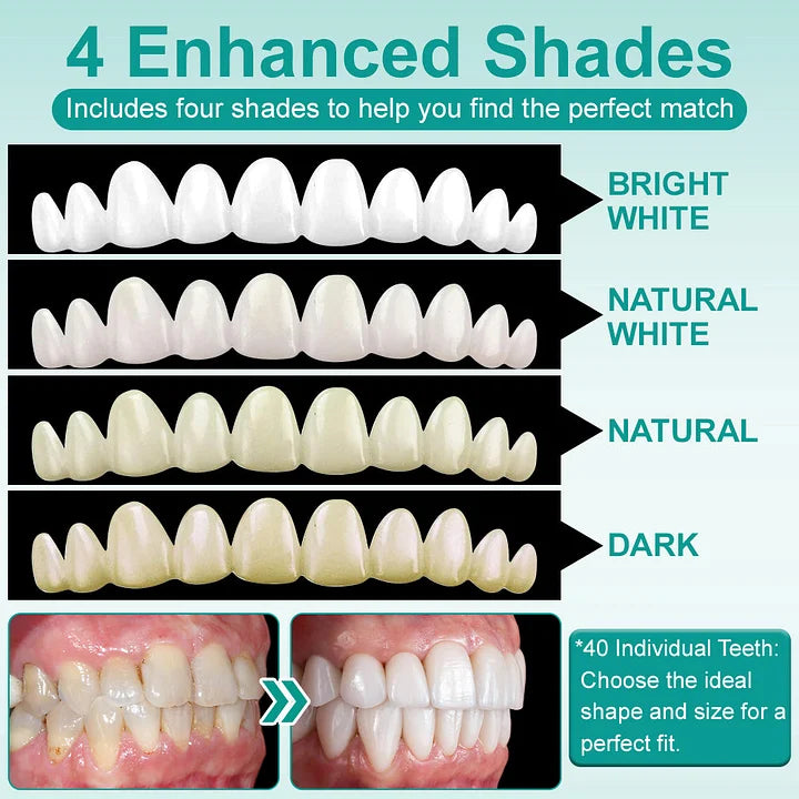 🧑‍⚕️🦷 YUNPSO™ Instant Stick-On Dental Veneers