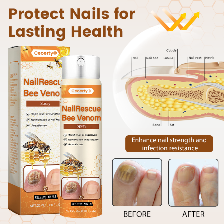 Ceoerty® NailRescue Bee Venom Spray