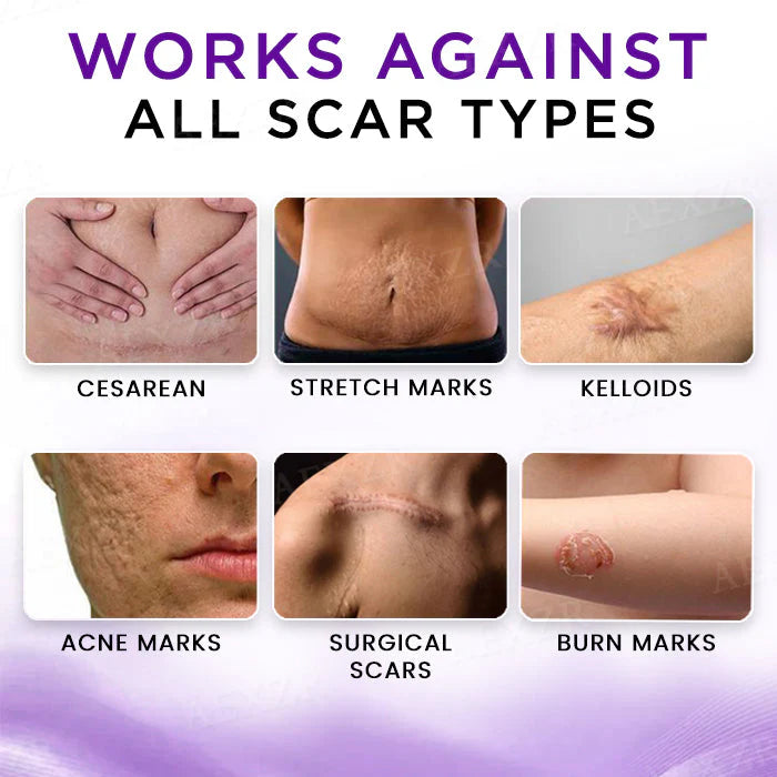 AEXZR® Cure Face & Body Scar Gel – Clinically proven to soften, flatten and fade surgical scars, acne marks, burns, keloids and trauma-related scars.