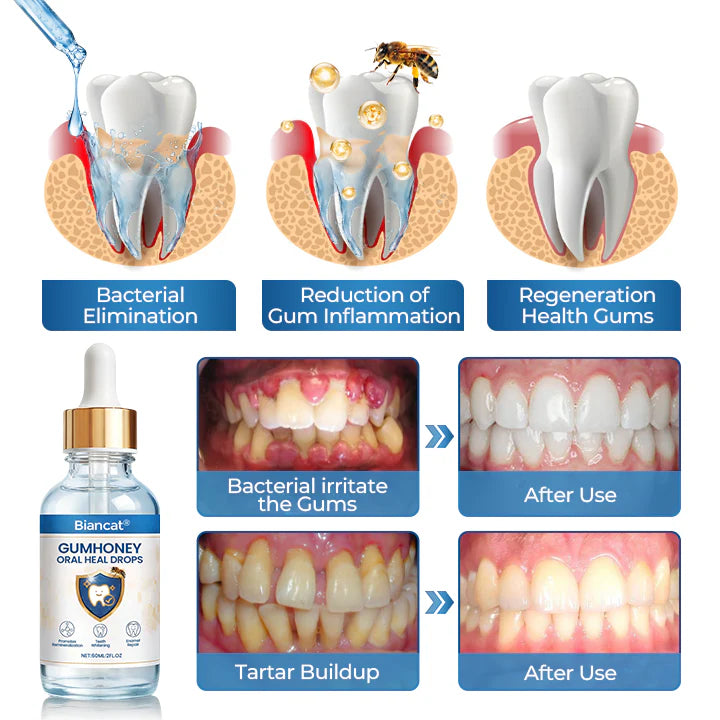 Biancat® GumHoney Oral Repair Drops  (19638 Reviews)
